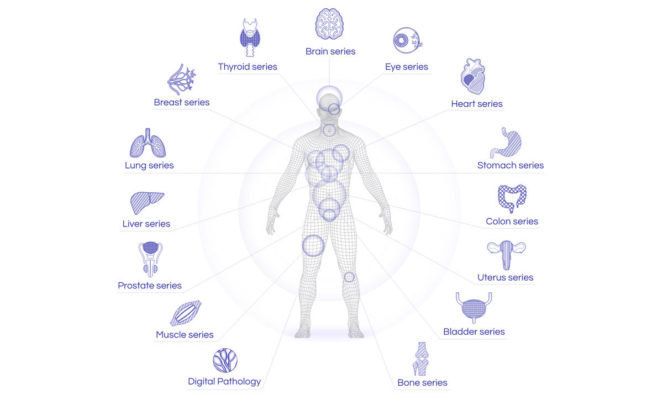 人工智能技术可对人体 14 个部位诊断 27 种病况。（资料来源：JLK Inspection）